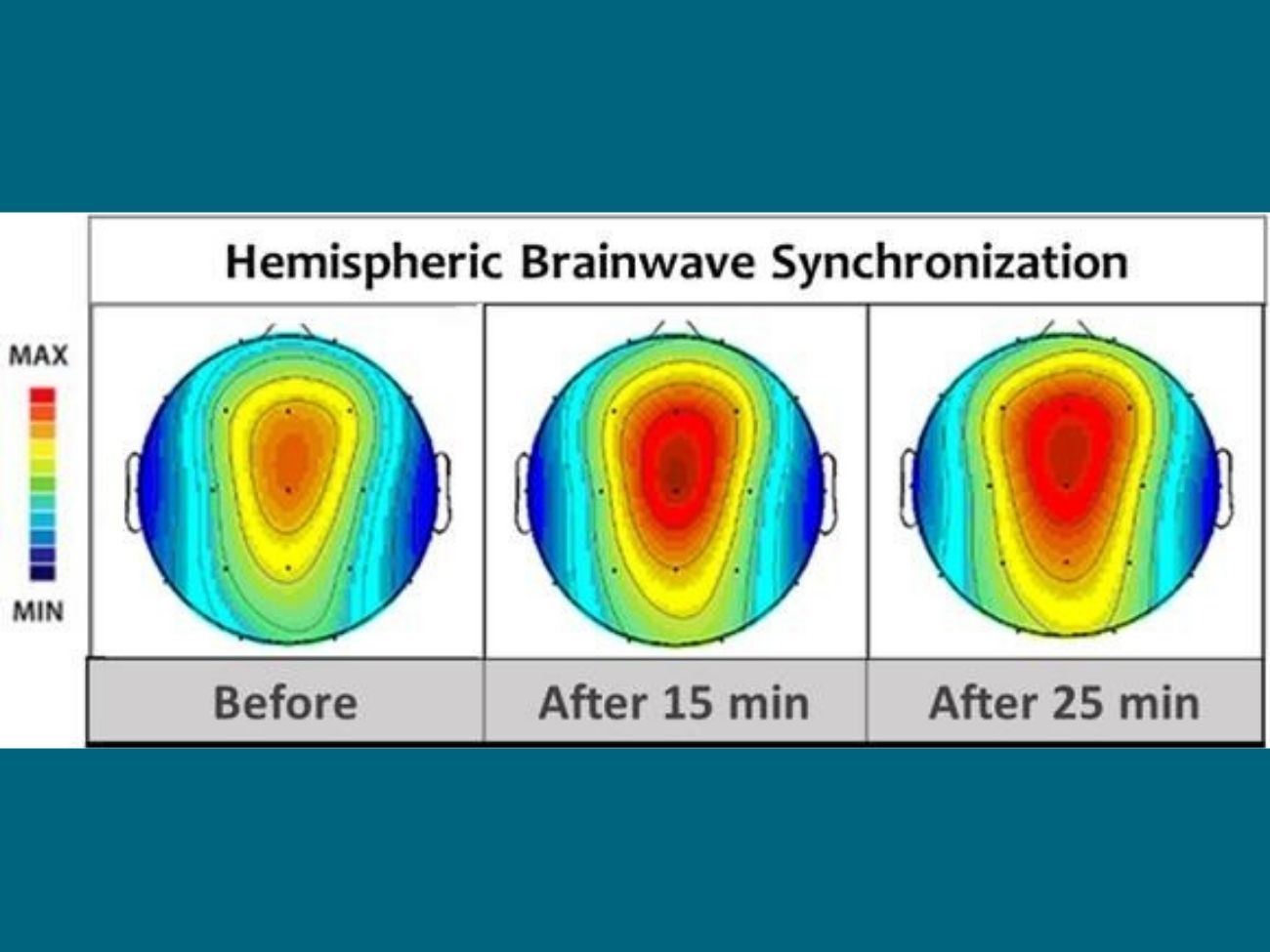 Exploring Hemi-Sync: A Powerful Tool for Mind and Consciousness Enhancement Anupma Chandra Make Happy Foundation